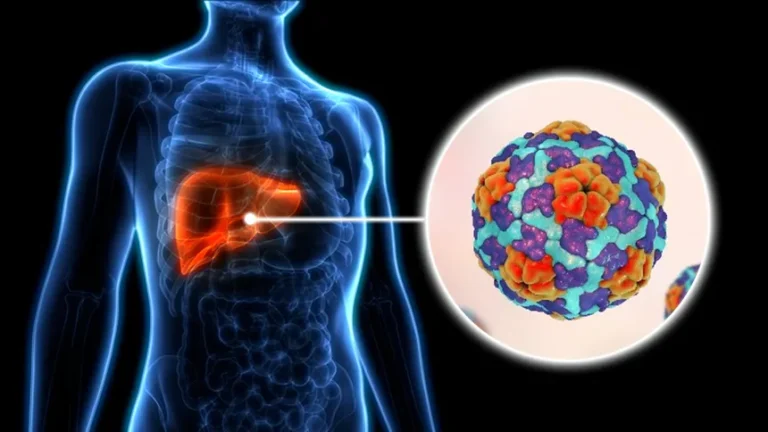 Viral Hepatitis & Liver Disease